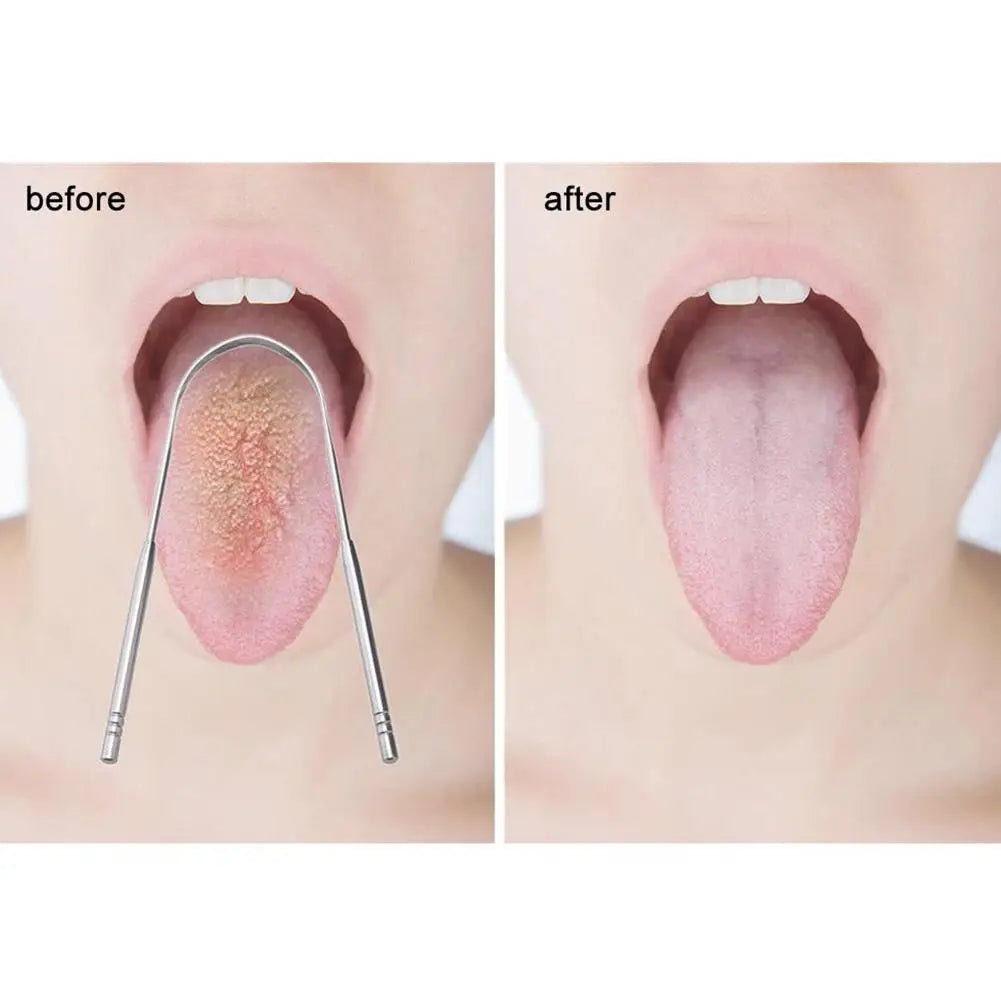 Stainless Tongue Scraper Cleaner