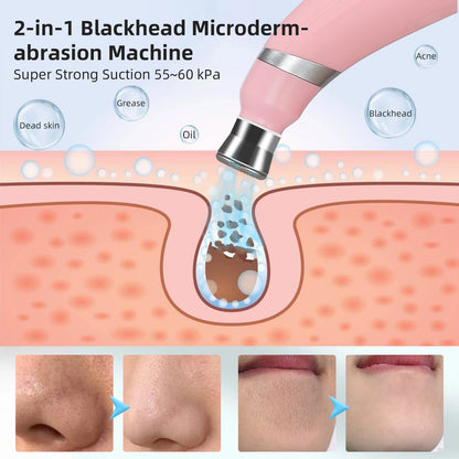 Portable Diamond Microdermabrasion Pen