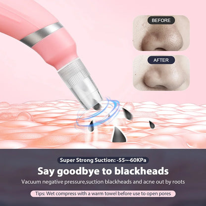 Portable Diamond Microdermabrasion Pen