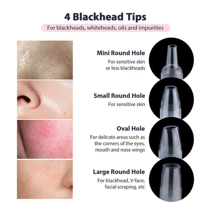 Portable Diamond Microdermabrasion Pen