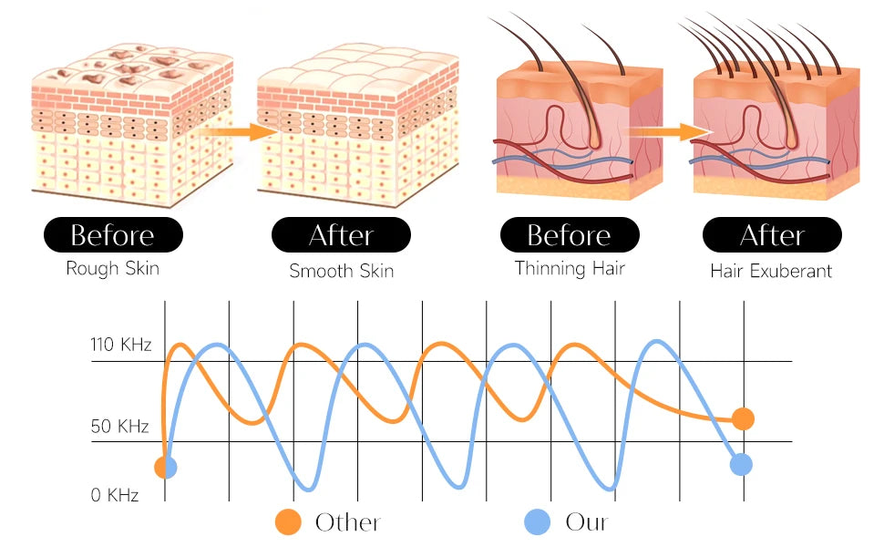 High Frequency Wand - Electrotherapy Facial Care