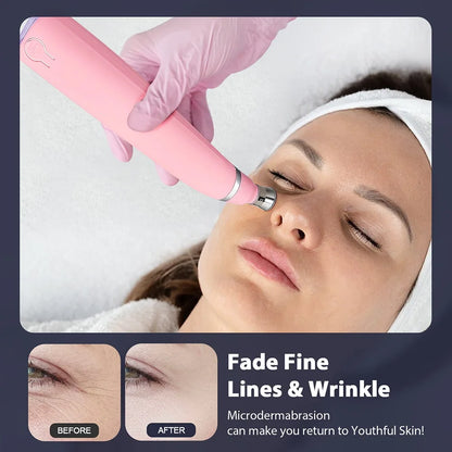 Portable Diamond Microdermabrasion Pen