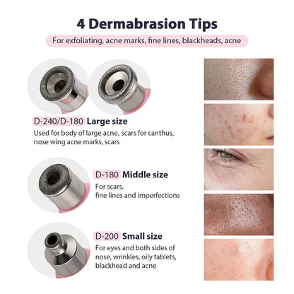 Portable Diamond Microdermabrasion Pen